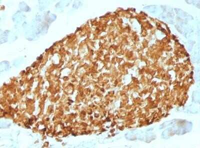 Immunohistochemistry-Paraffin: Chromogranin A Antibody (CHGA/798) - IHC-Prediluted [NBP2-48072]