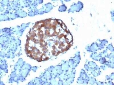 Immunohistochemistry-Paraffin: Chromogranin A Antibody (CHGA/798) - IHC-Prediluted [NBP2-48072]
