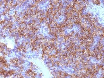 Immunohistochemistry-Paraffin: Chromogranin A Antibody (CHGA/798) [NBP2-44775]