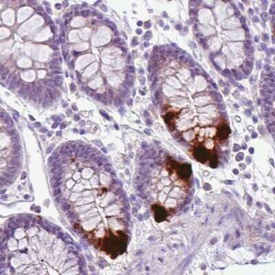 Immunohistochemistry-Paraffin: Chromogranin A Antibody (CL0166) [NBP2-52869]
