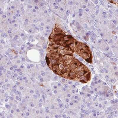 Immunohistochemistry-Paraffin: Chromogranin A Antibody (CL0166) [NBP2-52869]