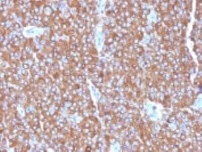 Immunohistochemistry-Paraffin: Chromogranin A Antibody (LK2H10 + PHE5 + CGA/414) - IHC-Prediluted [NBP2-44772]