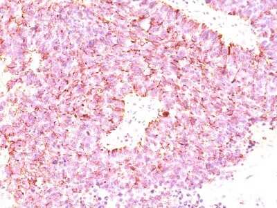 Immunohistochemistry-Paraffin: Chromogranin A Antibody (LK2H10 + PHE5 + CGA/414) - IHC-Prediluted [NBP2-44772]