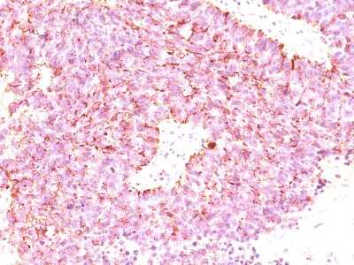 Immunohistochemistry-Paraffin: Chromogranin A Antibody (LK2H10 + PHE5 + CGA/414) [NBP2-34240]