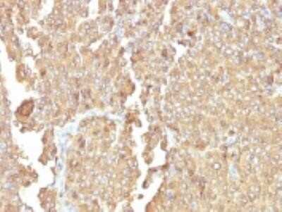 Immunohistochemistry-Paraffin: Chromogranin A Antibody (LK2H10 + PHE5) - IHC-Prediluted [NBP2-44771]