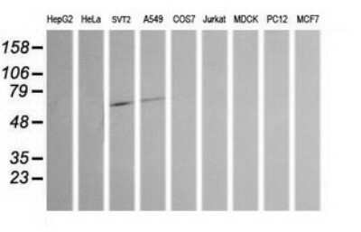 Western Blot: Chromogranin A Antibody (OTI2E12)Azide and BSA Free [NBP2-70410]