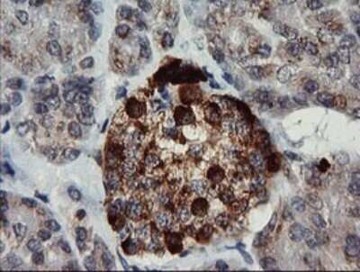 Immunohistochemistry: Chromogranin A Antibody (OTI2E12) [NBP2-46282]