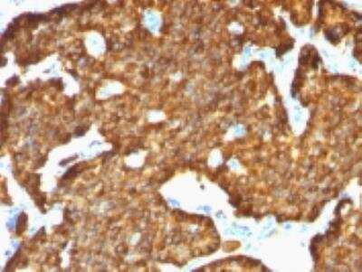 Immunohistochemistry-Paraffin: Chromogranin A Antibody (SPM553) [NBP2-32955]