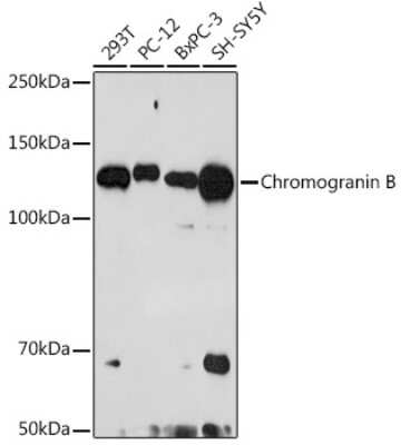 Western Blot: Chromogranin B Antibody (5N6T1) [NBP3-16206]