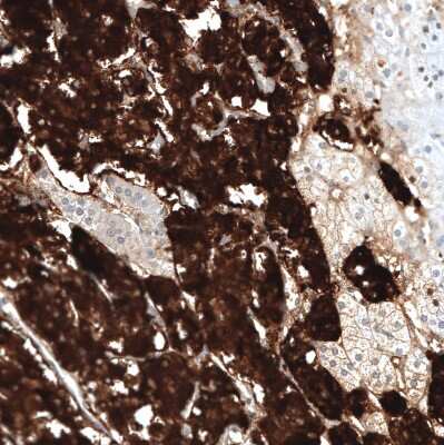 Immunohistochemistry-Paraffin: Chromogranin B Antibody (CL11404) [NBP3-15119]