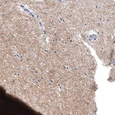 Immunohistochemistry-Paraffin: Chromogranin B Antibody (CL11404) [NBP3-15119]