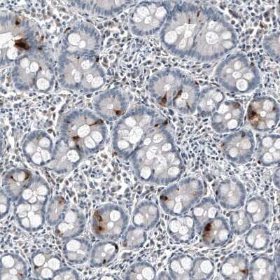 Immunohistochemistry-Paraffin: Chromogranin B Antibody (CL11404) [NBP3-15119]