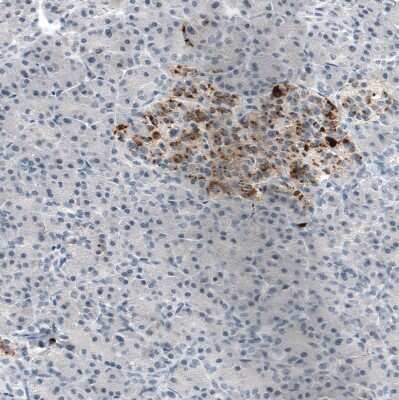 Immunohistochemistry-Paraffin: Chromogranin B Antibody (CL11404) [NBP3-15119]