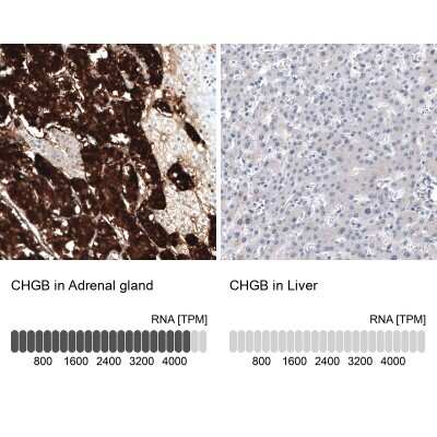 Immunohistochemistry-Paraffin: Chromogranin B Antibody (CL11404) [NBP3-15119]