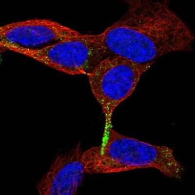 Immunocytochemistry/ Immunofluorescence: Chromogranin B Antibody [NBP1-80782]