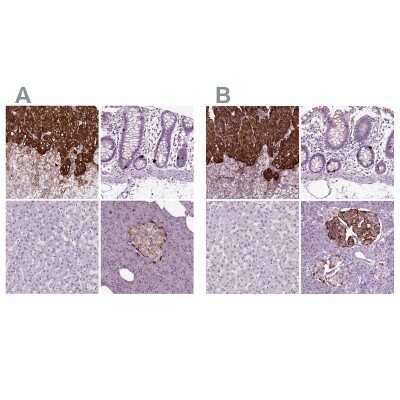 Immunohistochemistry-Paraffin: Chromogranin B Antibody [NBP1-80781]