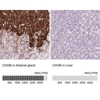 Immunohistochemistry-Paraffin: Chromogranin B Antibody [NBP1-80781]