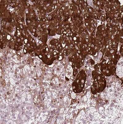 Immunohistochemistry-Paraffin: Chromogranin B Antibody [NBP1-80781]