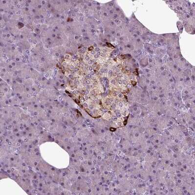 Immunohistochemistry-Paraffin: Chromogranin B Antibody [NBP1-80781]