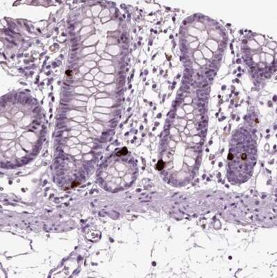 Immunohistochemistry-Paraffin: Chromogranin B Antibody [NBP1-80781]