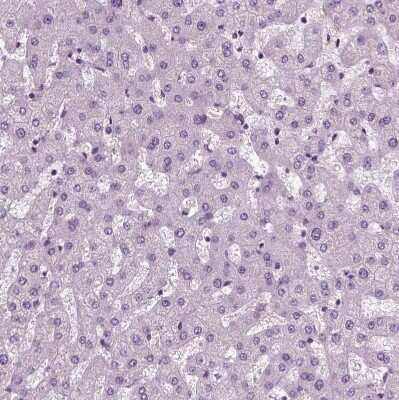 Immunohistochemistry-Paraffin: Chromogranin B Antibody [NBP1-80781]