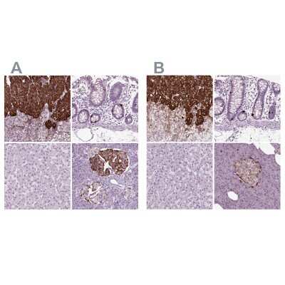 Immunohistochemistry-Paraffin: Chromogranin B Antibody [NBP1-80782]