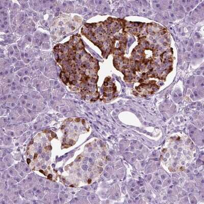 Immunohistochemistry-Paraffin: Chromogranin B Antibody [NBP1-80782]