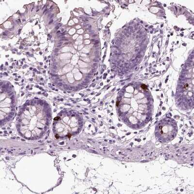 Immunohistochemistry-Paraffin: Chromogranin B Antibody [NBP1-80782]