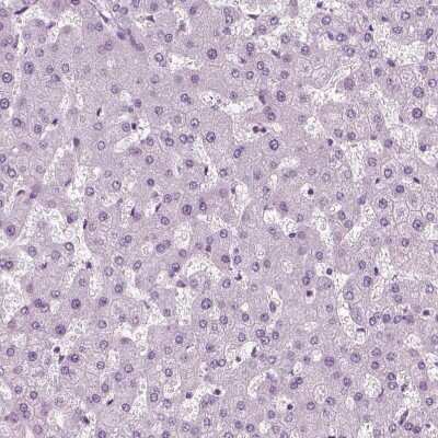 Immunohistochemistry-Paraffin: Chromogranin B Antibody [NBP1-80782]
