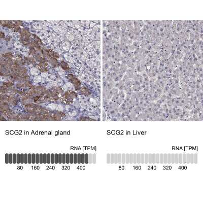 Immunohistochemistry-Paraffin: Chromogranin C Antibody [NBP2-62693]