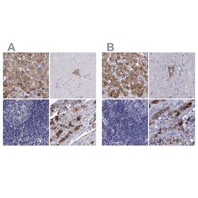 Immunohistochemistry-Paraffin: Chromogranin C Antibody [NBP2-62693]