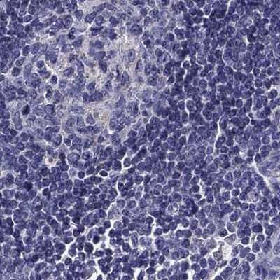 Immunohistochemistry-Paraffin: Chromogranin C Antibody [NBP2-62693]