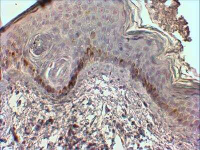 Immunohistochemistry-Paraffin: Chymase/CMA1/Mast Cell Chymase Antibody [NBP2-27551]