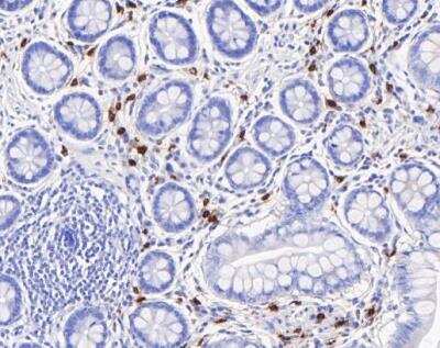 Immunohistochemistry-Paraffin: Chymase/CMA1/Mast Cell Chymase Antibody (JB74-32) [NBP2-75441]