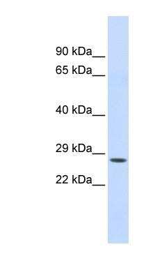 Western Blot: Chymotrypsin C/CTRC Antibody [NBP1-58035]