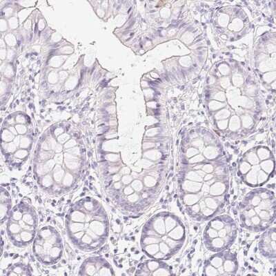 Immunohistochemistry-Paraffin: Chymotrypsin-like protease Antibody [NBP2-33973]