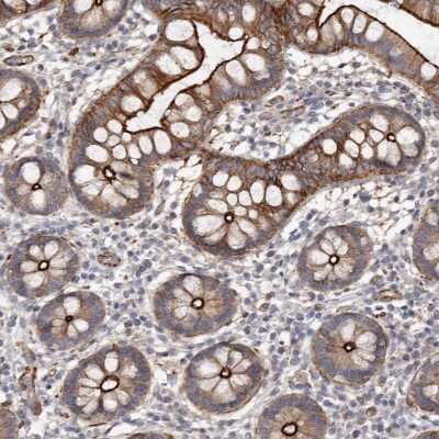 Immunohistochemistry-Paraffin: Cingulin Antibody [NBP1-89600]
