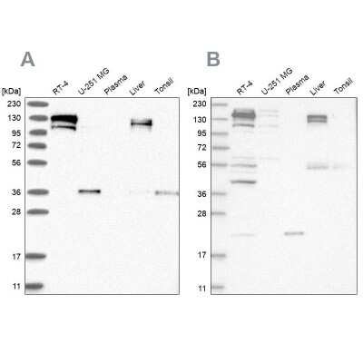 Western Blot: Cingulin Antibody [NBP1-89600]