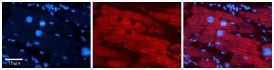 Immunohistochemistry-Paraffin: Cited-2 Antibody [NBP2-88786]