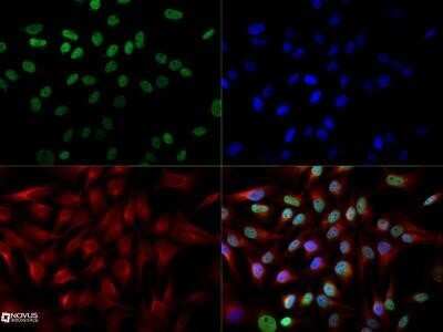 Immunocytochemistry/ Immunofluorescence: Cited-2 Antibody (JA22) - Azide and BSA Free [NBP2-80671]