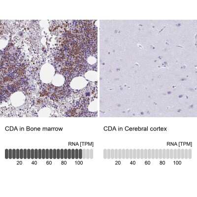 Immunohistochemistry-Paraffin: Citidine Deaminase Antibody [NBP2-39019]