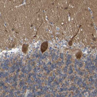 Immunohistochemistry-Paraffin: Citron Kinase Antibody [NBP1-88050]
