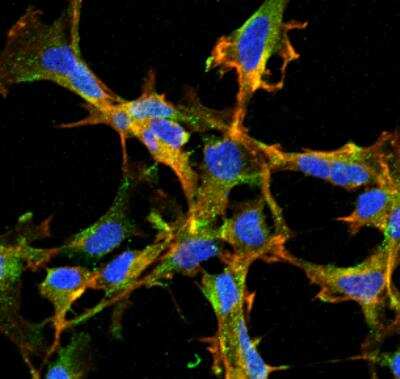 Immunocytochemistry/ Immunofluorescence: Citrulline Antibody (2D3.1) [NBP2-59364]
