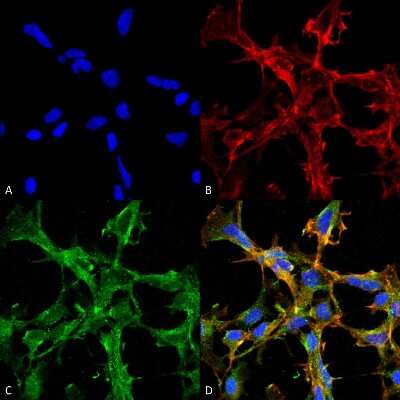 Immunocytochemistry/ Immunofluorescence: Citrulline Antibody (2D3.1) [NBP2-59364]