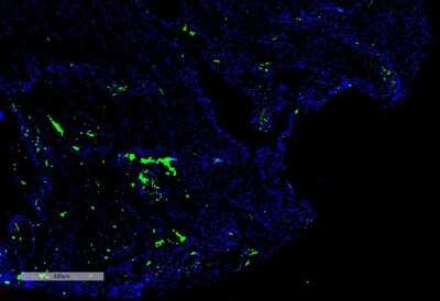 Immunohistochemistry: Citrulline Antibody (2D3.1) [NBP2-59364]