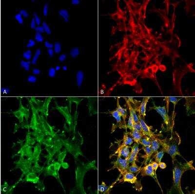 Immunocytochemistry/ Immunofluorescence: Citrulline Antibody (6C2.1) [NBP2-59365]