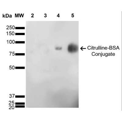 Western Blot: Citrulline Antibody (6C2.1) [NBP2-59365]