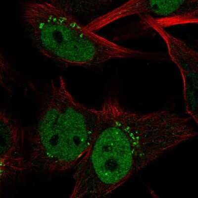 Immunocytochemistry/ Immunofluorescence: Claspin Antibody [NBP2-55290]