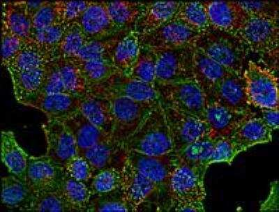 Immunocytochemistry/ Immunofluorescence: Clathrin Heavy Chain 1/CHC17 Antibody (BF-06) [NBP1-45050]