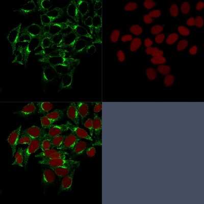 Immunocytochemistry/ Immunofluorescence: Clathrin Heavy Chain 1/CHC17 Antibody (CHC/1432) - Azide and BSA Free [NBP3-08333]